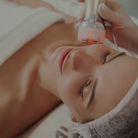 Radiofrecuencia facial